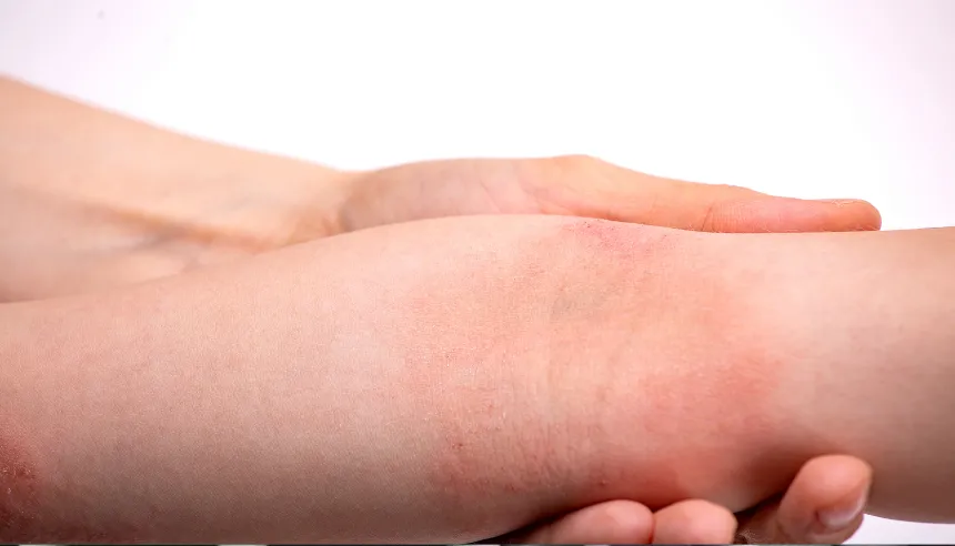 Especialista examinando afeccion de la piel en consulta dermatologica
